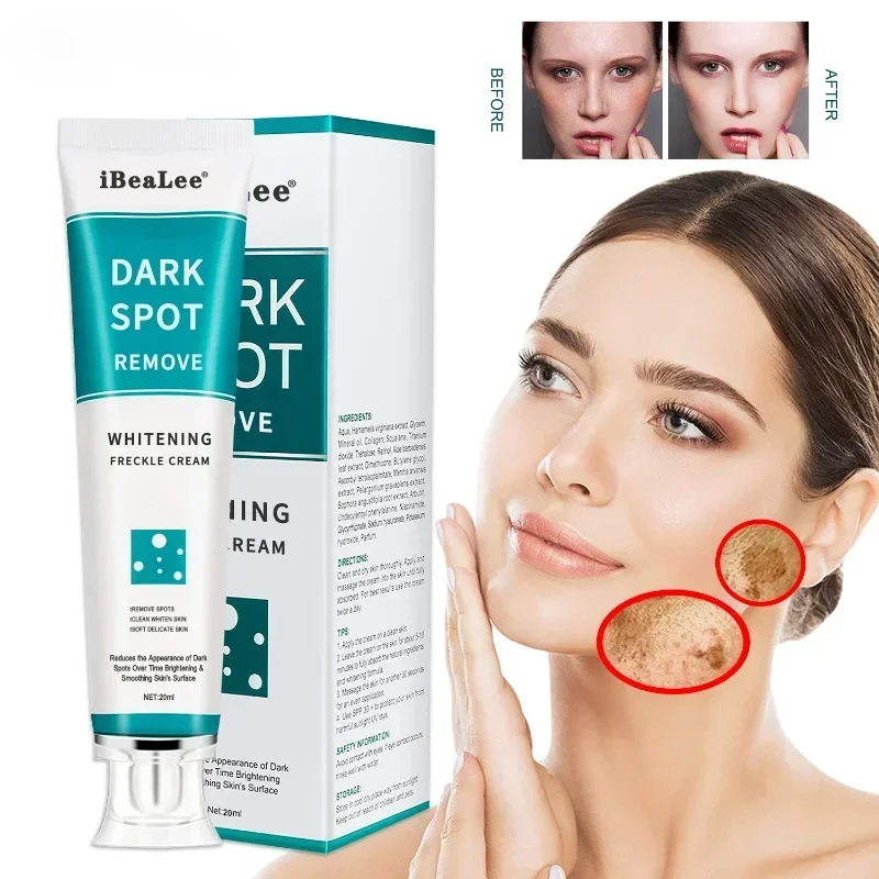 Wybielający krem ​​do piegów U – Skincare Glowing recenzja i cena