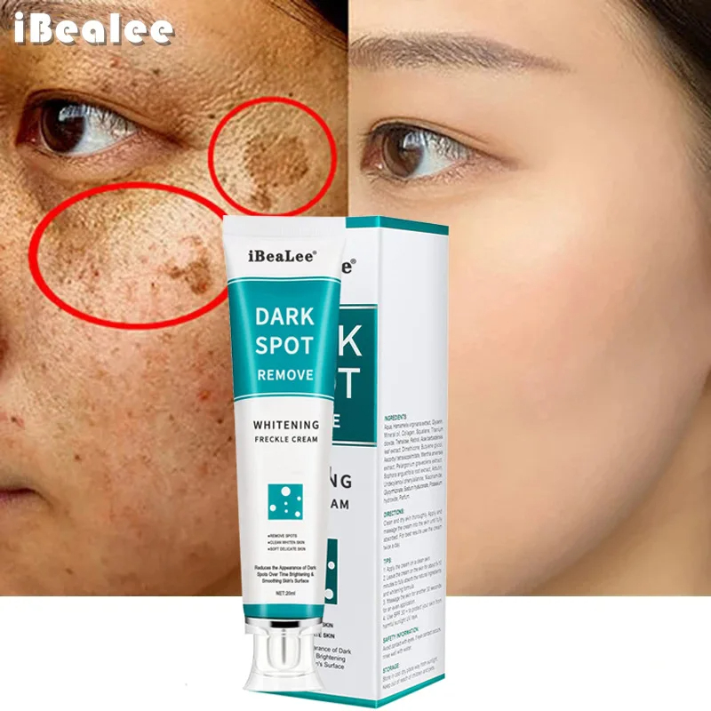 Wybielający krem ​​do piegów U – Skincare Glowing recenzja i cena