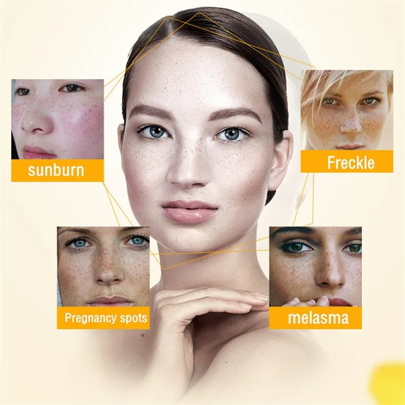 Wybielający krem ​​do piegów U – Skincare Glowing recenzja i cena